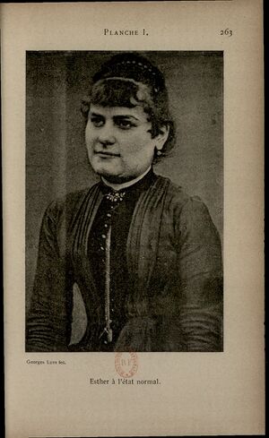 Luys Hypnotisme Planche I - Esther etat normal.jpg