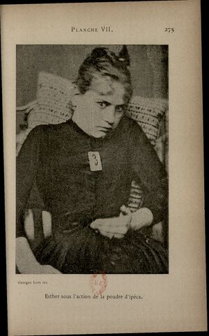 Luys Hypnotisme Planche VII.jpg